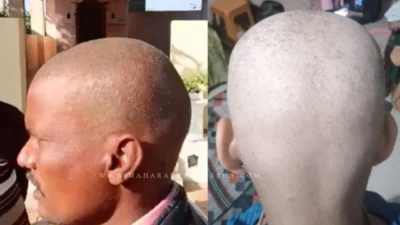 Hair loss । बुलढाण्यातील लोकांना टक्कल का पडला? कारण जाणून व्हाल हैराण, तुम्ही करत नाही ना 'ही' चूक? Hair loss । बुलढाण्यातील लोकांना टक्कल का पडला? कारण जाणून व्हाल हैराण, तुम्ही करत नाही ना 'ही' चूक?