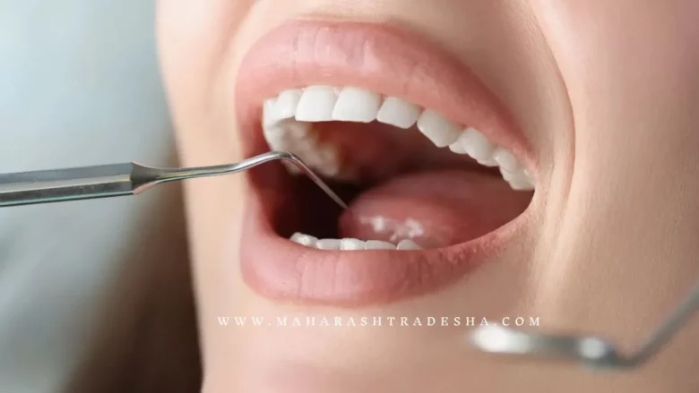 Mouth Cancer Symptoms, dont ignored it