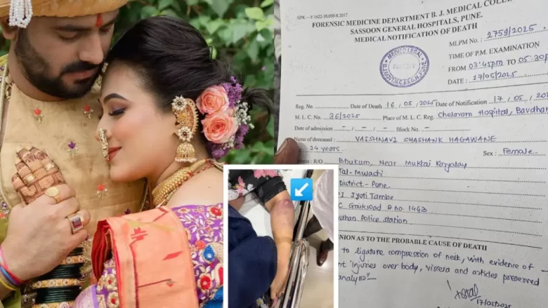 Postmortem report in Vaishnavi Hagawane suicide case reveals shocking injuries and signs of strangulation. Police confirm dowry harassment and physical assault. Political links make case more serious.